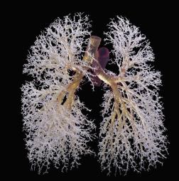 hutchings-ralph-resin-cast-of-lungs-bronchi-only-anterior-view.jpg