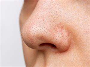 shutterstock_2084653261_nose_deguns.jpg