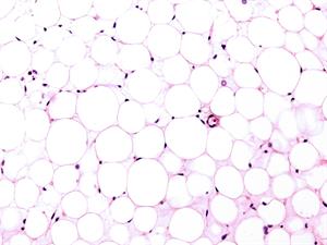 Shutterstock_1541866631_adipose tissue_taukaudi.jpg