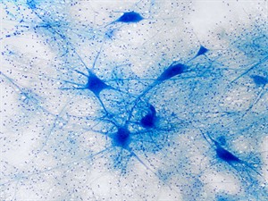 Shutterstock_1452113915_neurons_neironi.jpg