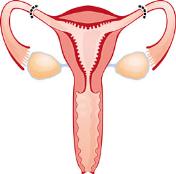female_sterilization.jpg