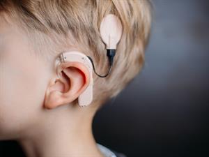 Shutterstock_1657967119_cochlear implant_dzirdes aparāts.jpg