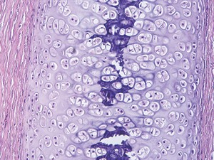 shutterstock_643150642_cilveka_skrimsla_saistaudu_histologija_.jpeg