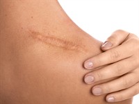 shutterstock_708844276_scar_rēta.jpg