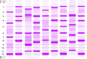 YCUZD_230915_5549_elektroforēzes atdalīšana_2.png