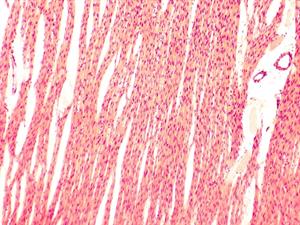 Shutterstock_434160871_heart muscle_sirds muskulis (1).jpg