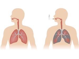 Shutterstock_410254807_healthy and smokers lungs_veselas un smēķētāja plaušas.jpg