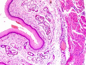 shutterstock_112825057_squamous epithelium tissue cell_daudzkārtainais epitēlījs.jpg