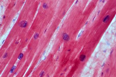 C0320443-Heart_muscle,_light_micrograph.jpg