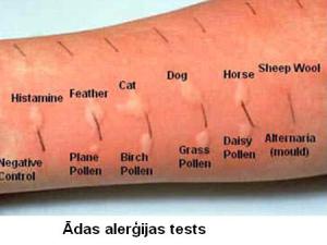 allergy-testf8.JPG
