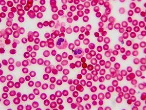 Shutterstock_1421837909_blood cells_asins šūnas.jpg