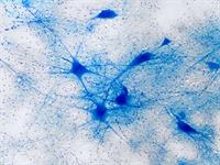 Shutterstock_1452113915_neurons_neironi.jpg