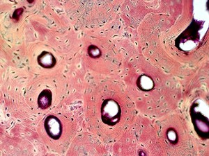 shutterstock_1365236543_bone tissue_kaulaudi.jpg