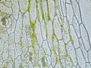 Shutterstock_118552645_Hloroplasti gaismas mikroskopā.jpg